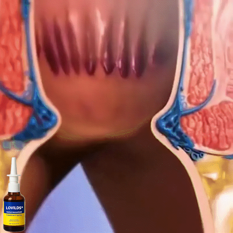 LOVILDS® Hemorrhoid Spray image LOVILDS® Hemorrhoid Spray